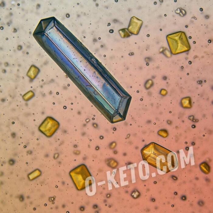 Why do carbohydrates acidify urine instead of protein?
