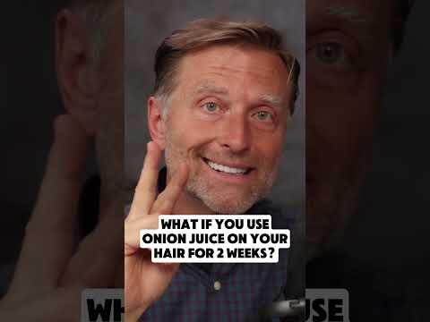 Onion Juice for Extreme Hair Growth Onion Juice for Extreme Hair Growth