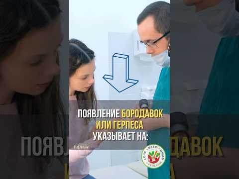 Бородавки