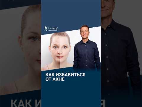 НЕ делайте этого, если хотите избавиться от акне!