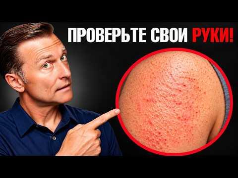 Шершавая кожа на руках: о чем говорят бугорки и при чем здесь витамин A Шершавая кожа на руках: о чем говорят бугорки и при чем здесь витамин A