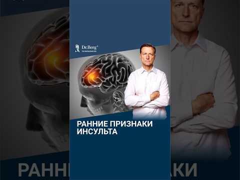 3 САМЫХ ранних признака инсульта🙌 3 САМЫХ ранних признака инсульта🙌