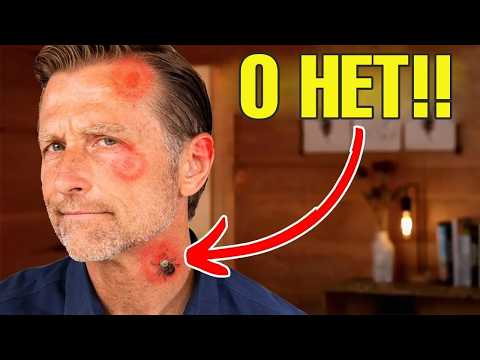 Как предотвратить боррелиоз (болезнь Лайма)?🧐