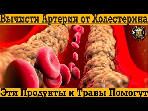 Вычисти Артерии и Печень от Холестерина БЫСТРО!