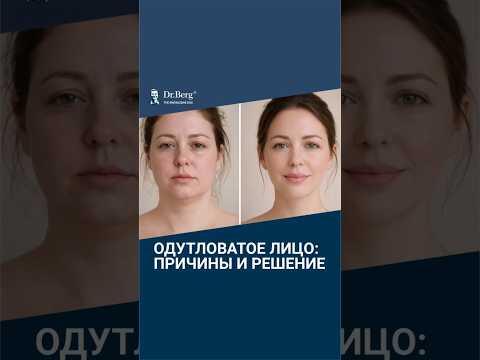 Круглое одутловатое лицо? Поэтому у вас отечное лицо НА САМОМ ДЕЛЕ