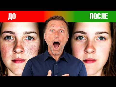 Лучший пробиотик при аутоиммунных заболеваниях🙌