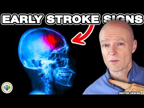 10 Warnings Signs Of STROKE A Week BEFORE It Happens 10 Warnings Signs Of STROKE A Week BEFORE It Happens