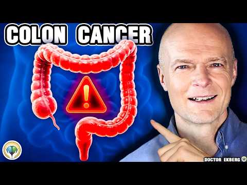 #1 Absolute Best Way To Prevent Colon Cancer