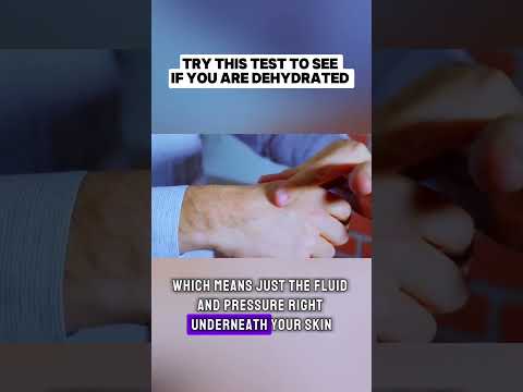 Try This Simple Test to Check If You Are Dehydrated