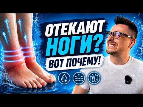 ОТЕКАЮТ НОГИ? Вот почему организм задерживает воду ОТЕКАЮТ НОГИ? Вот почему организм задерживает воду