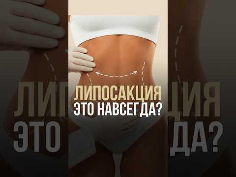 Липосакция - это навсегда Липосакция - это навсегда