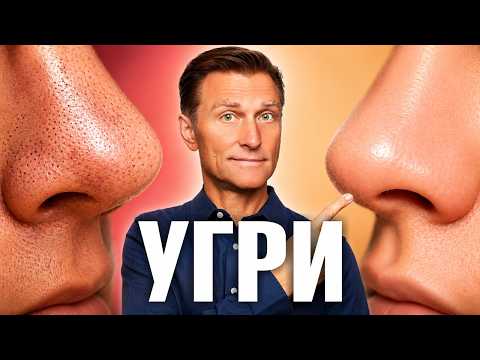 Средство №1 от черных точек🔥