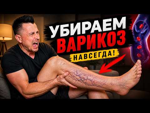 ВАРИКОЗ: причины, симптомы и лечение | как работают клапаны вен, застой крови и роль коллагена ВАРИКОЗ: причины, симптомы и лечение | как работают клапаны вен, застой крови и роль коллагена