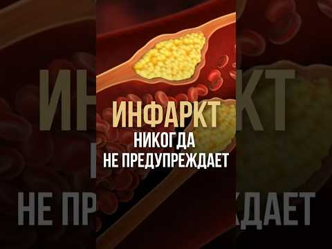 Инфаркт никогда не предупреждает