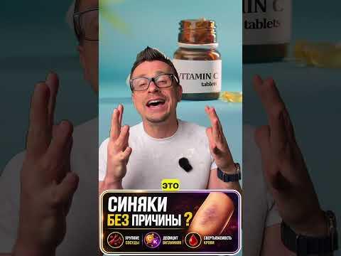 Синяки без причины? Синяки без причины?