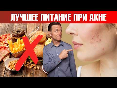 Как избавиться от акне быстрее всего?👀