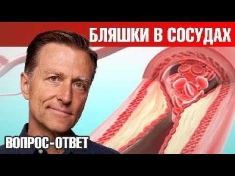 Как избавиться от бляшек в сосудах? Как избавиться от ГЭРБ? 🧐 Как избавиться от бляшек в сосудах? Как избавиться от ГЭРБ? 🧐