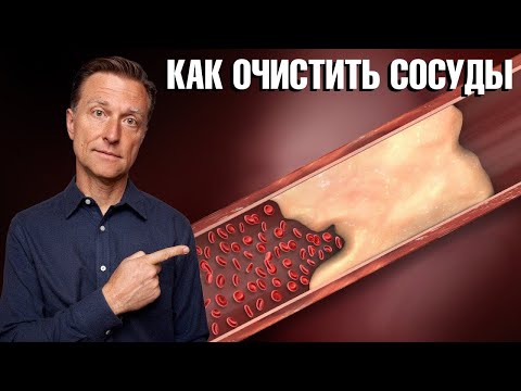 Кальцификация сосудов? Проблемы с сердцем? Причина в этом. 🙌