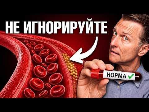 Перестаньте бояться высокого холестерина, пока не узнаете ЭТО🙌 Перестаньте бояться высокого холестерина, пока не узнаете ЭТО🙌
