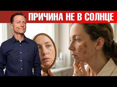 Как убрать пигментные пятна на лице? Как убрать пигментные пятна на лице?
