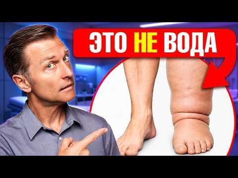 Лимфедема и питание: о чем не говорят врачи