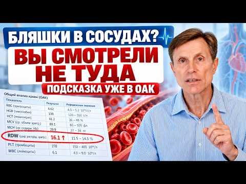 Узнать про бляшки в сосудах дома - анализ есть у каждого, просто вы не туда смотрели Узнать про бляшки в сосудах дома - анализ есть у каждого, просто вы не туда смотрели