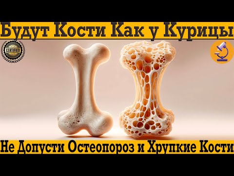 Будут кости как у курицы! Предотврати остеопороз, хрупкие кости, суставы и связки! Будут кости как у курицы! Предотврати остеопороз, хрупкие кости, суставы и связки!