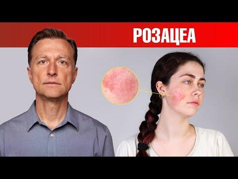 Если у вас розацеа, то ЭТО поможет. 🙌 Если у вас розацеа, то ЭТО поможет. 🙌