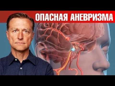 Боитесь инсульта? Бойтесь АНЕВРИЗМЫ. ☠ Причины аневризмы. Боитесь инсульта? Бойтесь АНЕВРИЗМЫ. ☠ Причины аневризмы.