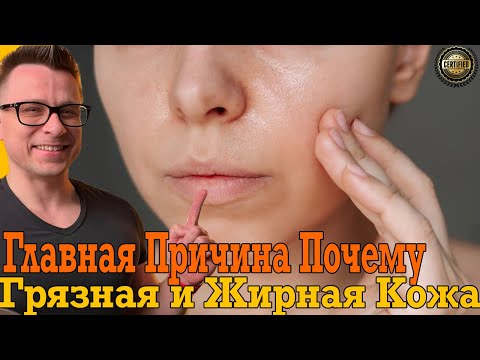 Грязная и жирная кожа останется в прошлом! Как быстро избавиться от акне и прыщей!