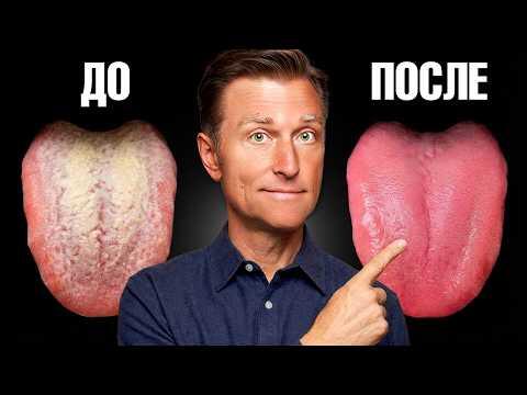 Как избавиться от кандиды за 24 часа?🔥 Как избавиться от кандиды за 24 часа?🔥