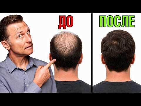 ПРИЧИНА №1 выпадения волос🙌 ПРИЧИНА №1 выпадения волос🙌