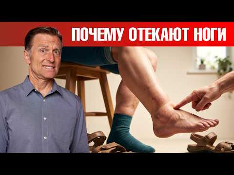 Отекают стопы? Отеки стоп и лодыжек: как решить проблему?🧐