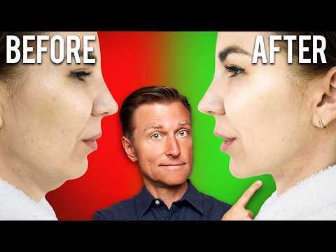 Fastest Way to Rid Your DOUBLE CHIN (Turkey Neck) Fastest Way to Rid Your DOUBLE CHIN (Turkey Neck)