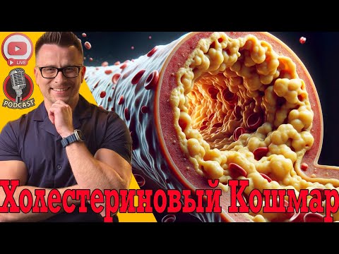 Все пропитано ХОЛЕСТЕРИНОМ! Атеросклероз, бляшки и закупоренные сосуды!