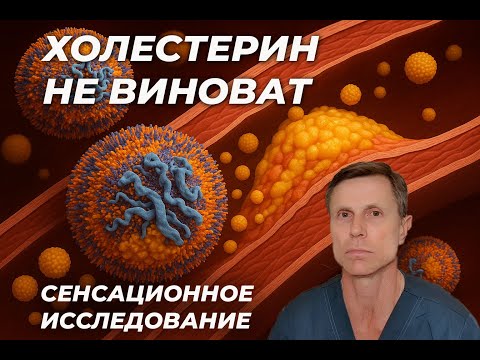 Сенсационное исследование : бляшки в сосудах не связаны с высоким холестерином. Революция в науке! Сенсационное исследование : бляшки в сосудах не связаны с высоким холестерином. Революция в науке!