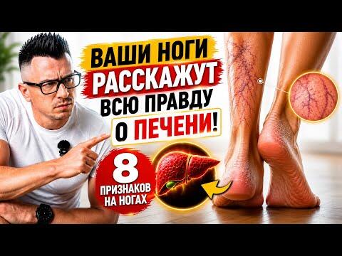 Ваши ноги расскажут всю правду о печени