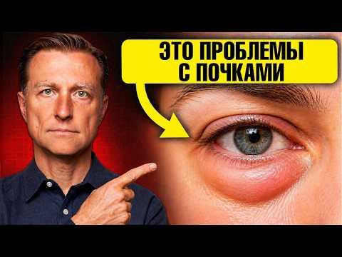 Проблемы с почками можно заметить ПО ГЛАЗАМ🙌
