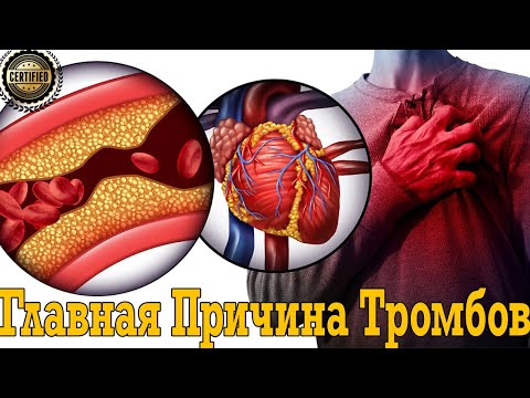Продли себе жизнь! Избавься от тромбов и очисть артерии и сосуды от холестерина!