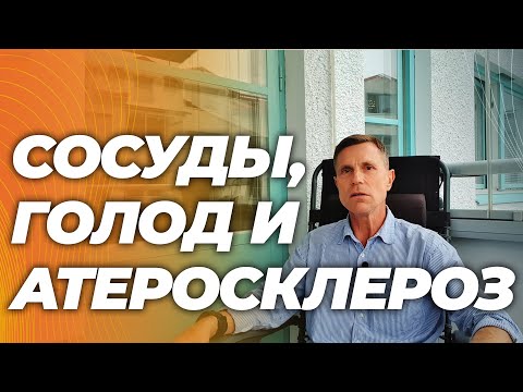 Можно ли верить слухам об атеросклерозе у узников концлагерей ?