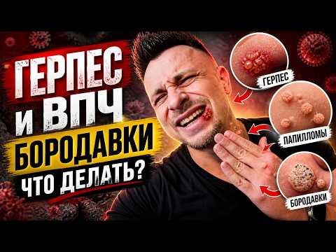 Герпес, ВПЧ, бородавки: что делать и как лечить правильно Герпес, ВПЧ, бородавки: что делать и как лечить правильно