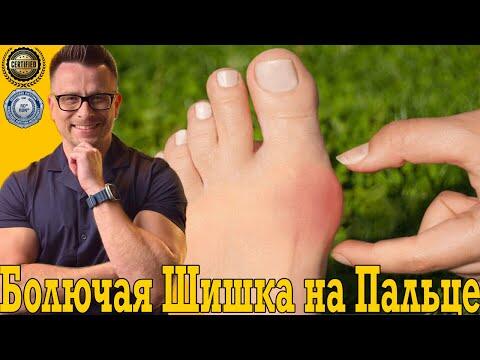 Растет болючая шишка на пальце ноги! Пяточная шпора, панкреатит, поджелудочная Растет болючая шишка на пальце ноги! Пяточная шпора, панкреатит, поджелудочная