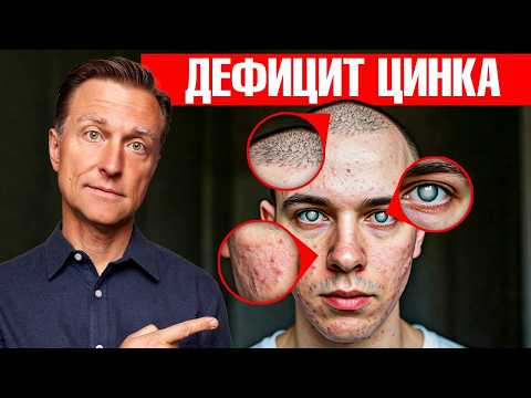 7 признаков дефицита цинка, которые превратят вашу жизнь в АД😲 7 признаков дефицита цинка, которые превратят вашу жизнь в АД😲
