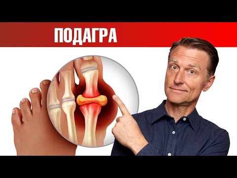 Натуральное и очень действенное средство от подагры 👍