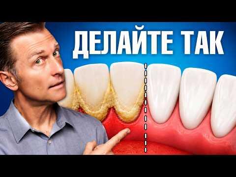 Как забыть о зубном камне навсегда: 4 простых шага🙌 Как забыть о зубном камне навсегда: 4 простых шага🙌