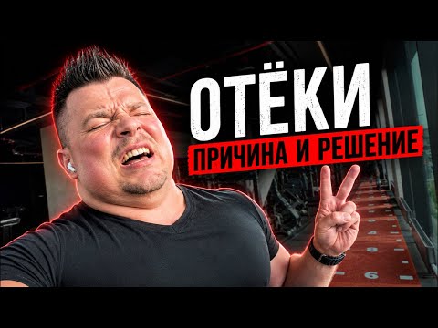 ОТЁКИ: КАК СЛИТЬ ЛИШНЮЮ ВОДУ • ОТЕКАЕТ ЛИЦО И НОГИ?
