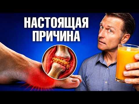 Как избавиться от подагры: делайте ЭТО каждый день🙌 Как избавиться от подагры: делайте ЭТО каждый день🙌