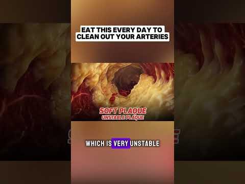 Eat This DAILY to Unclog Your Arteries