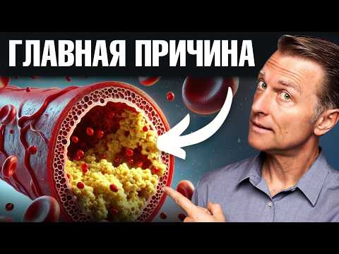 Лучшая пища для очищения сосудов!✅ Лучшая пища для очищения сосудов!✅