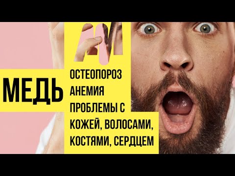 Медь